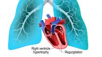 illustration of heart